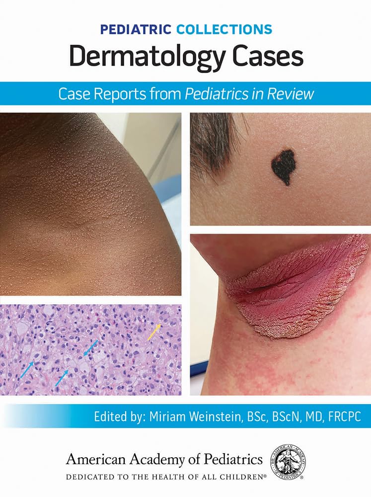 Pediatric Collections: Dermatology Cases: Case Reports from Pediatrics in Review
