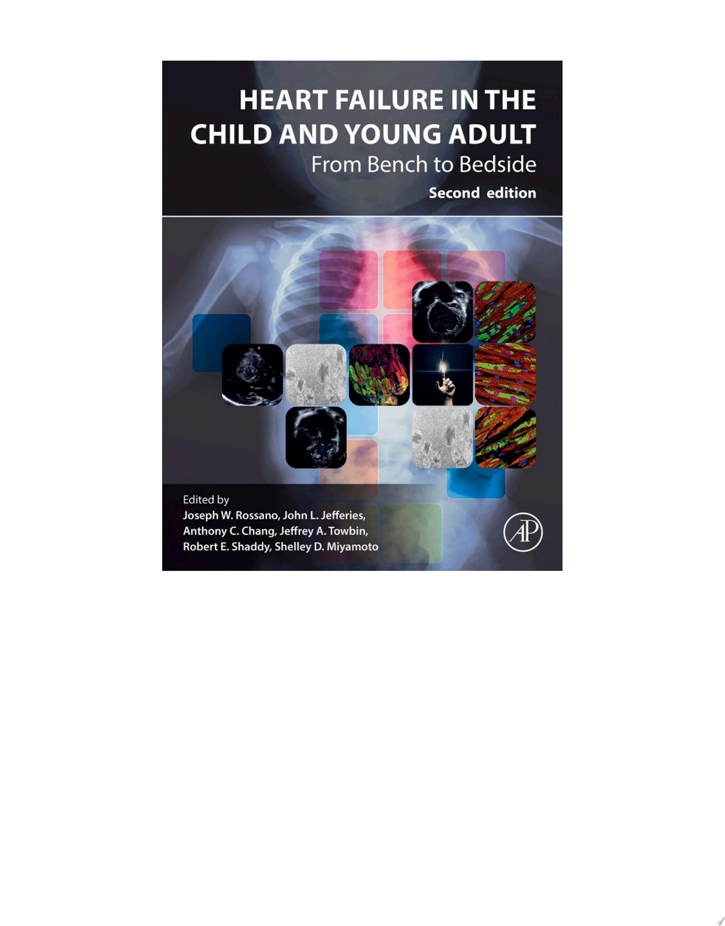 Heart Failure in the Child and Young Adult