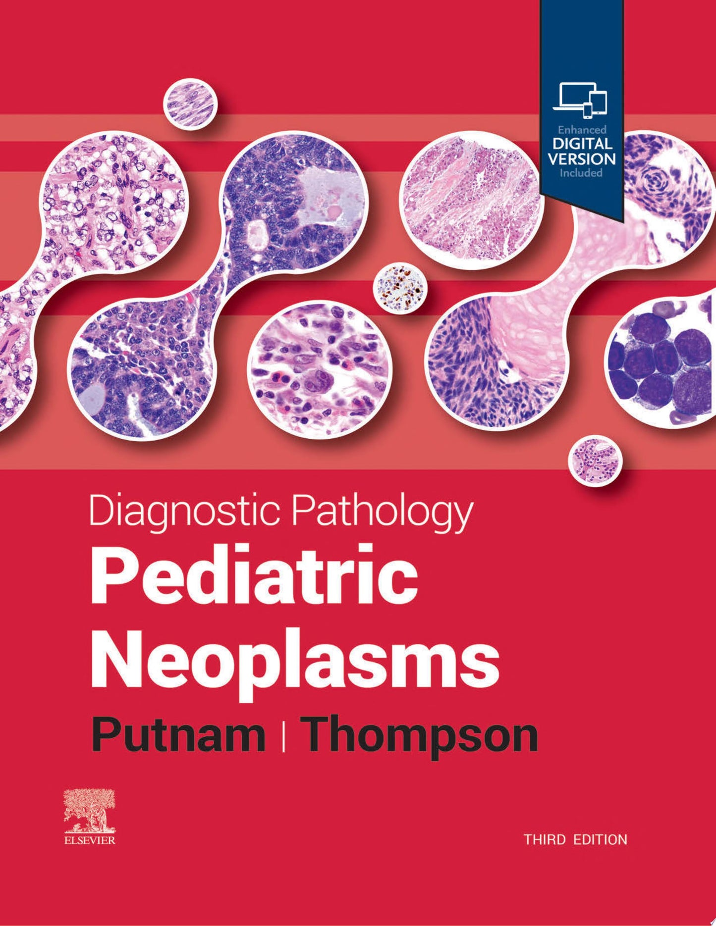 Diagnostic Pathology: Pediatric Neoplasms - E-BOOK