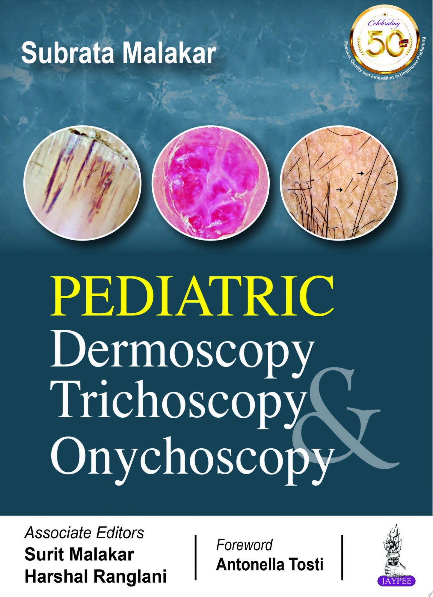 Pediatric Dermoscopy Trichoscopy & Onychoscopy