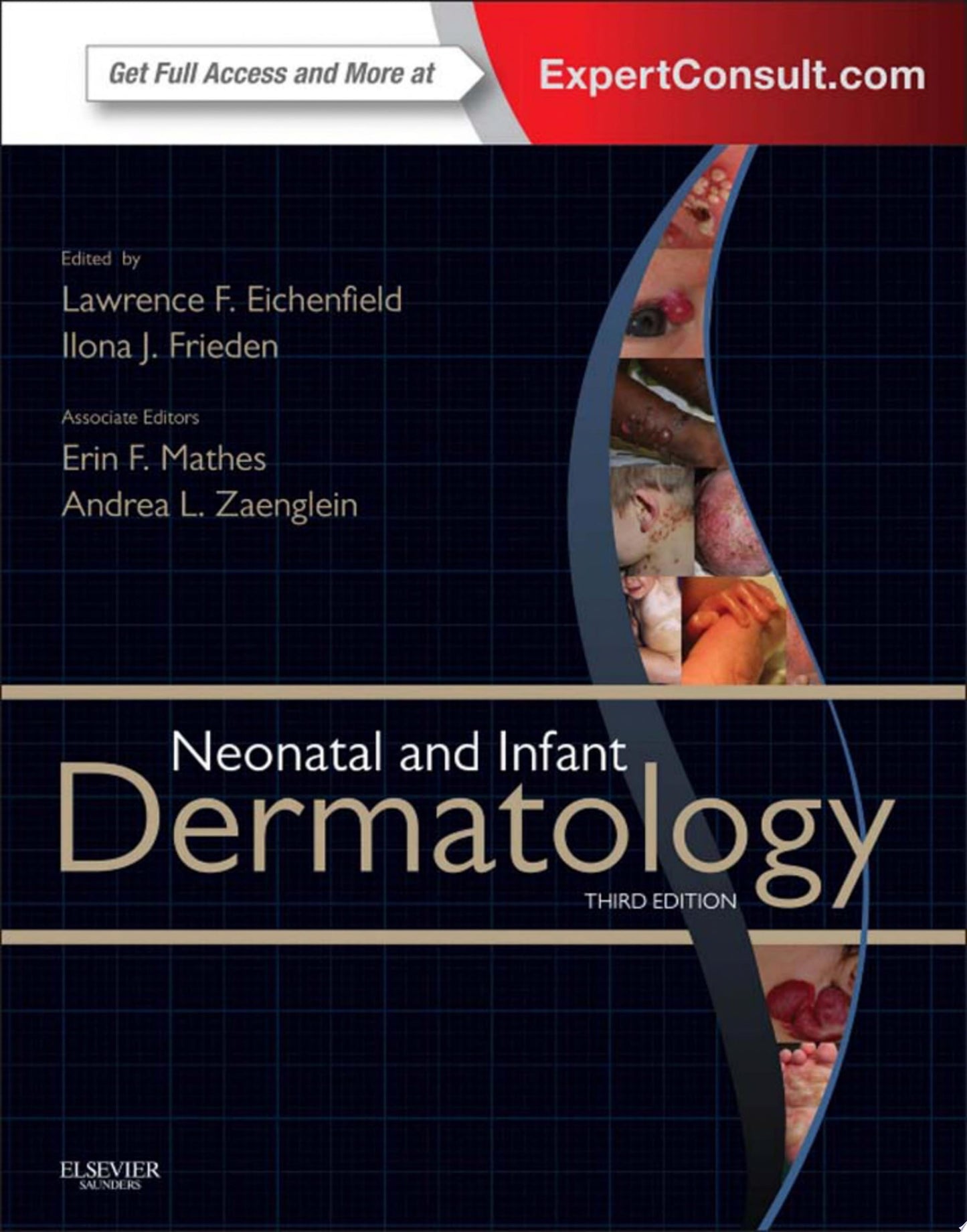 Neonatal and Infant Dermatology E-Book