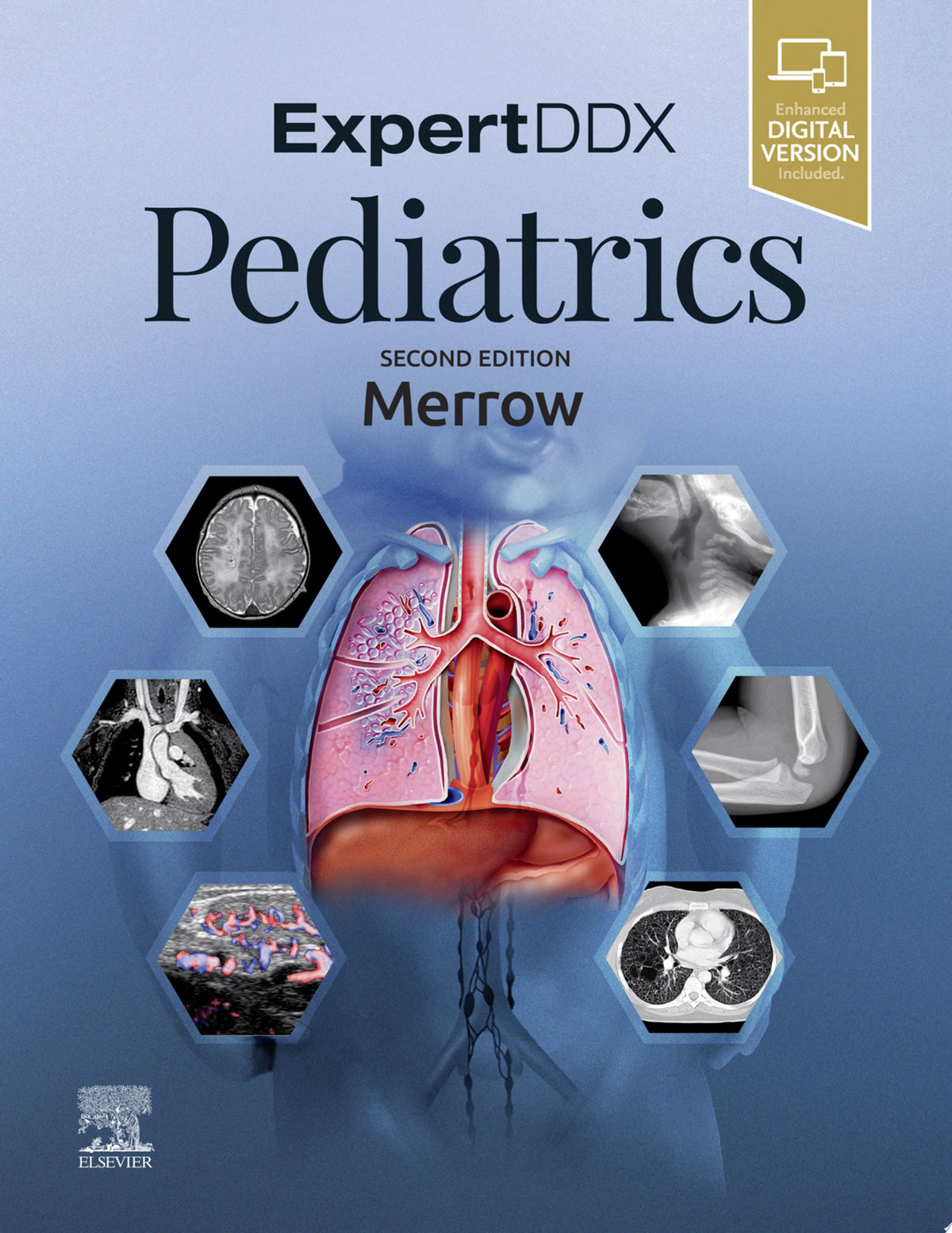 EXPERTddx: Pediatrics, Second Edition