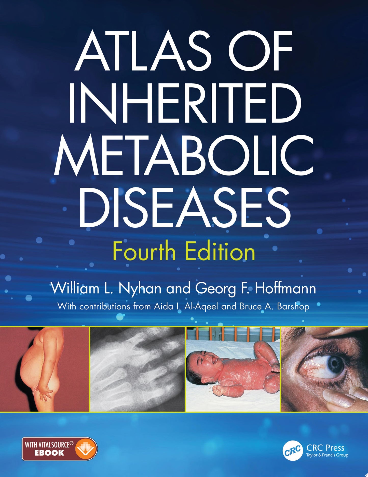 Atlas of Inherited Metabolic Diseases 4th edition