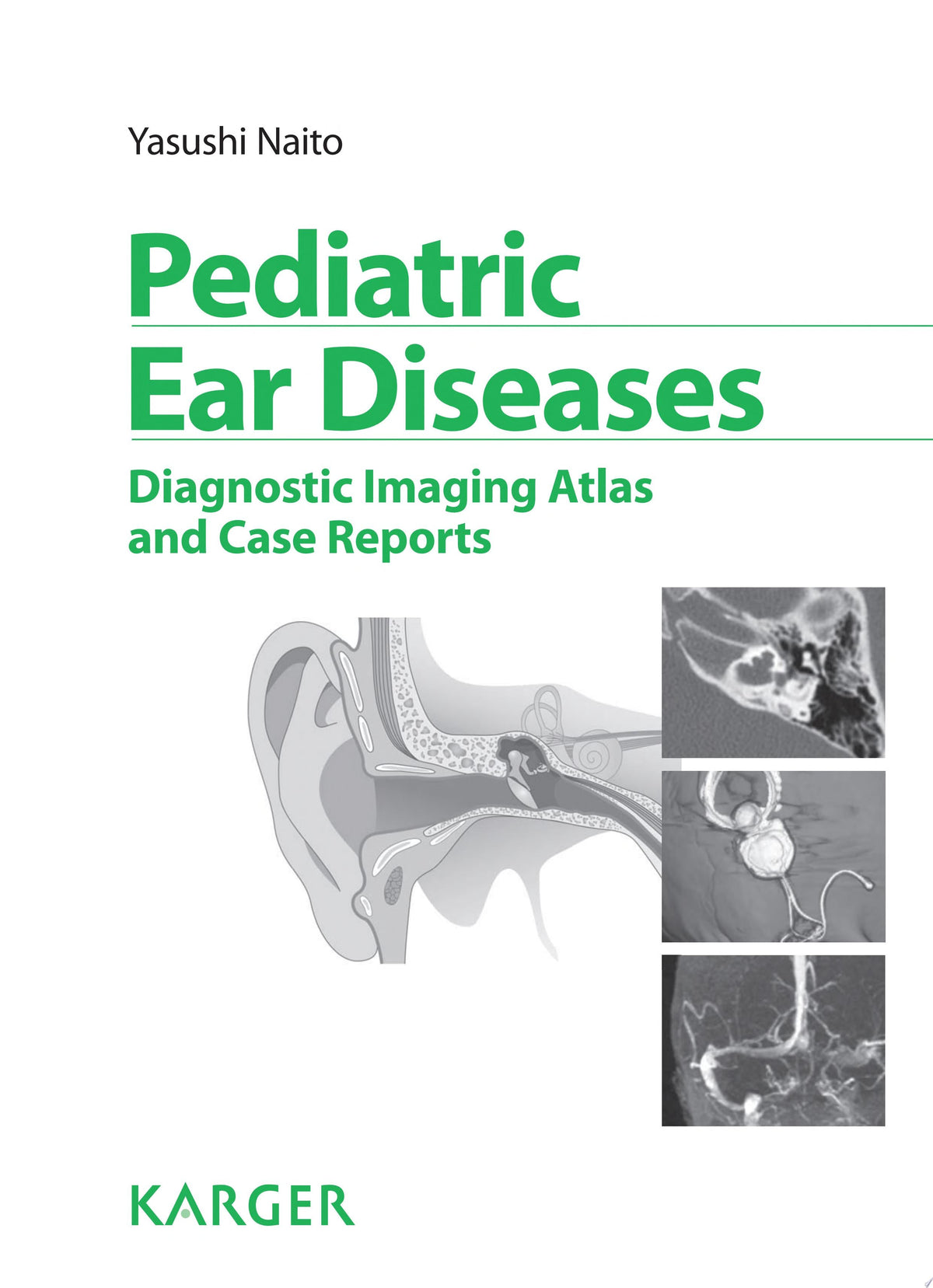 Pediatric Ear Diseases