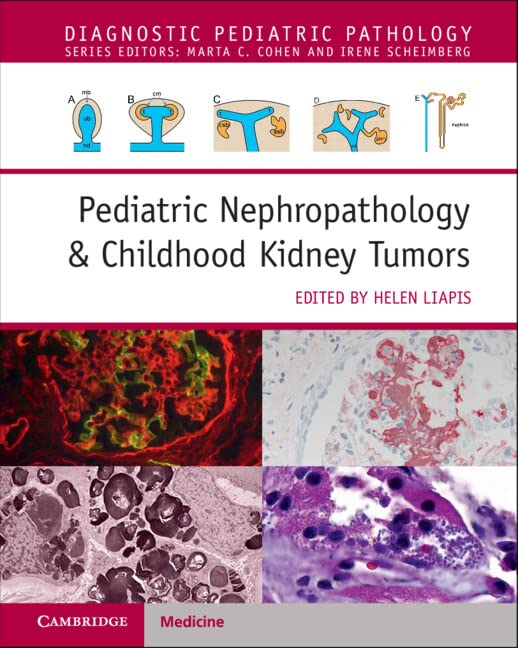 Pediatric Nephropathology and Childhood Kidney Tumors