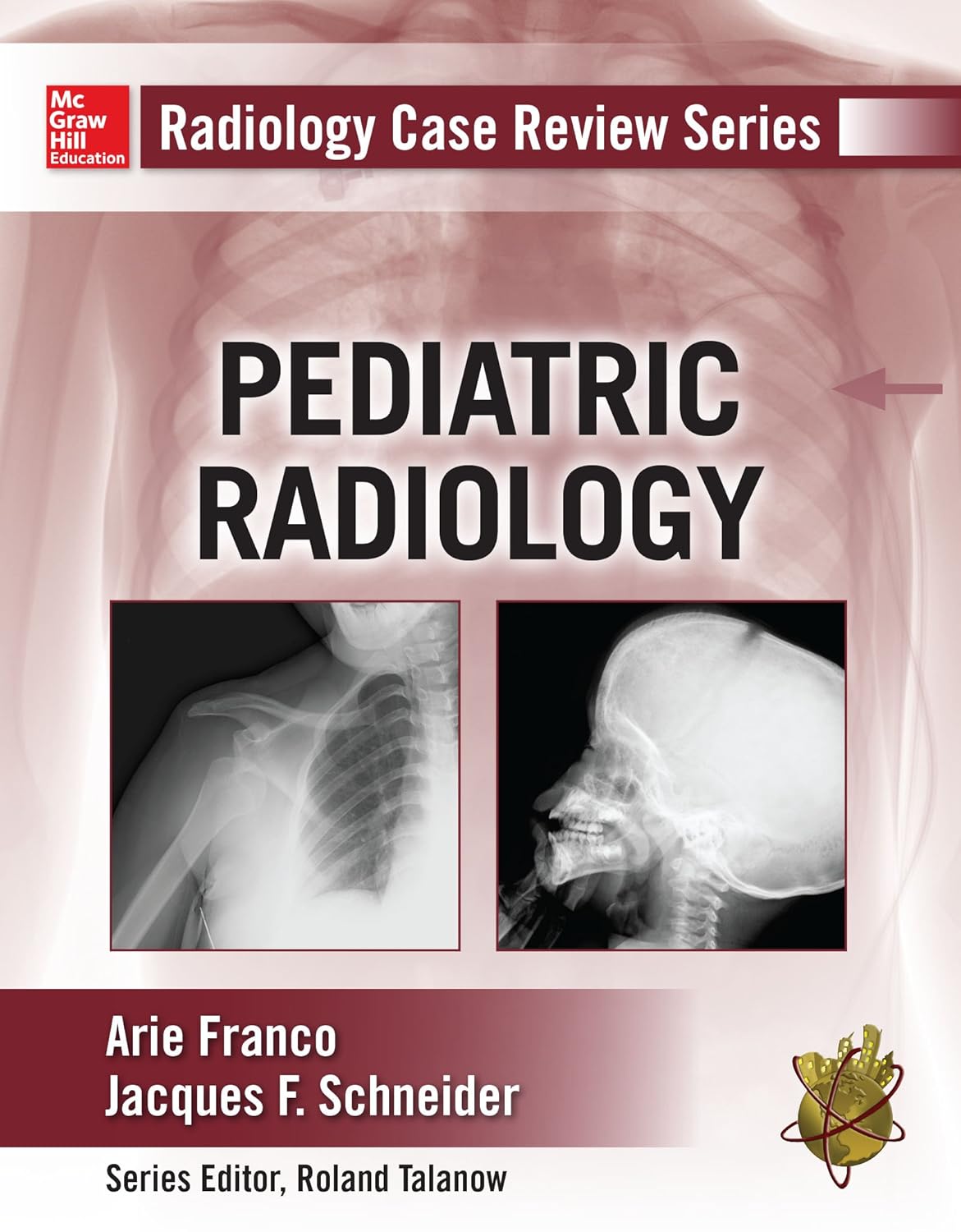 Radiology Case Review Series: Pediatric