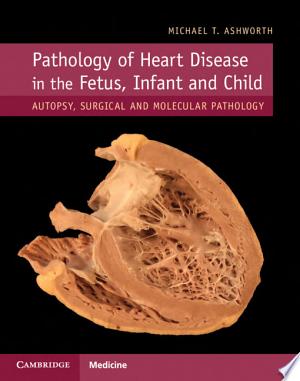 Pathology of Heart Disease in the Fetus, Infant and Child