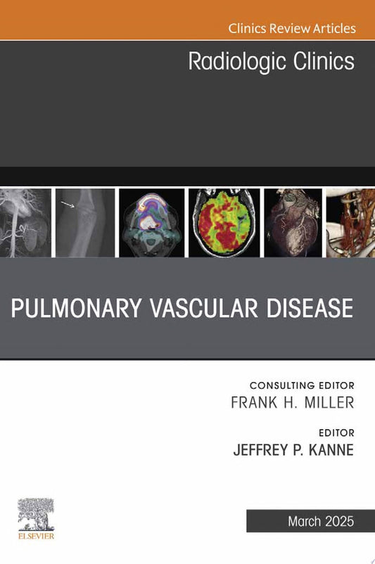 Pulmonary Vascular Disease, An Issue of Radiologic Clinics of North America