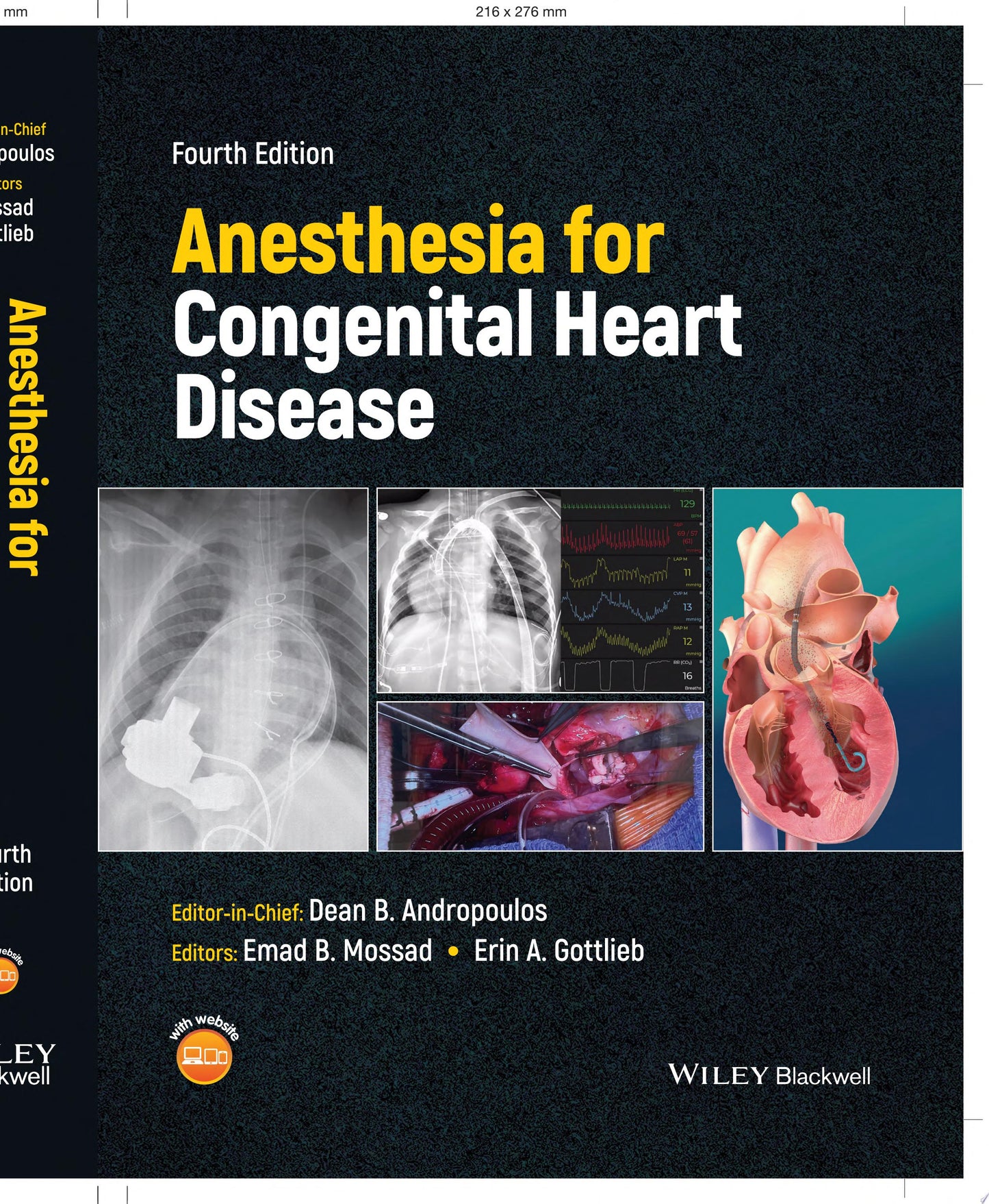 Anesthesia for Congenital Heart Disease