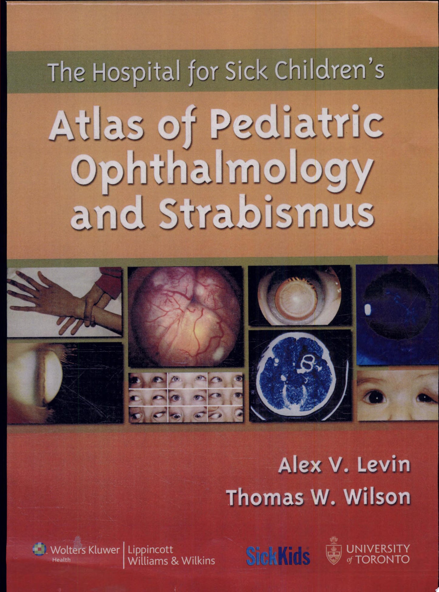 The Hospital for Sick Children's Atlas of Pediatric Ophthalmology and Strabismus