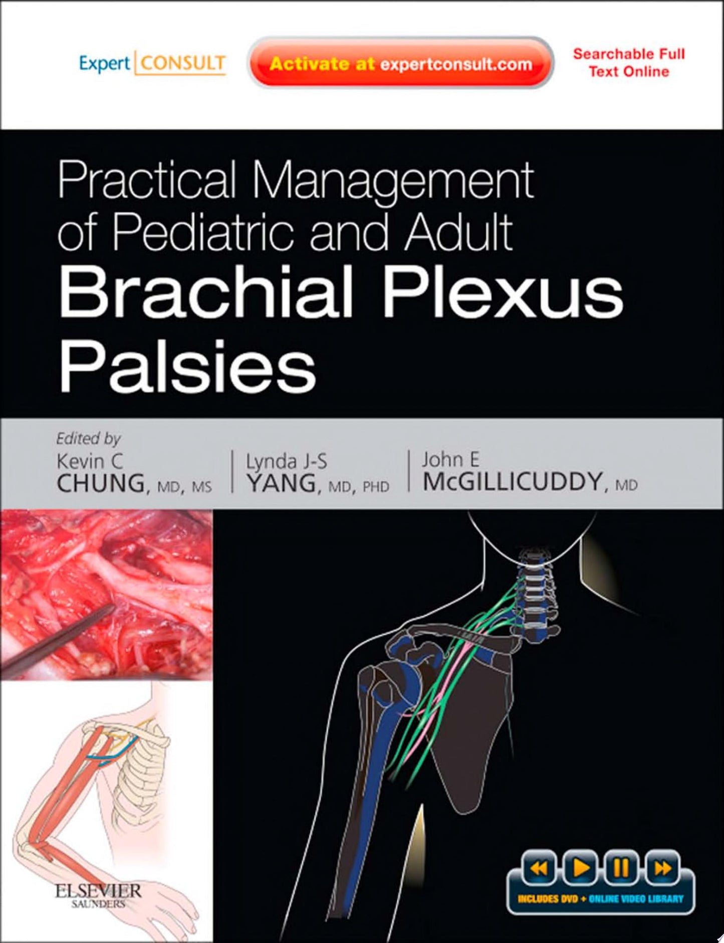 Practical Management of Pediatric and Adult Brachial Plexus Palsies E-Book