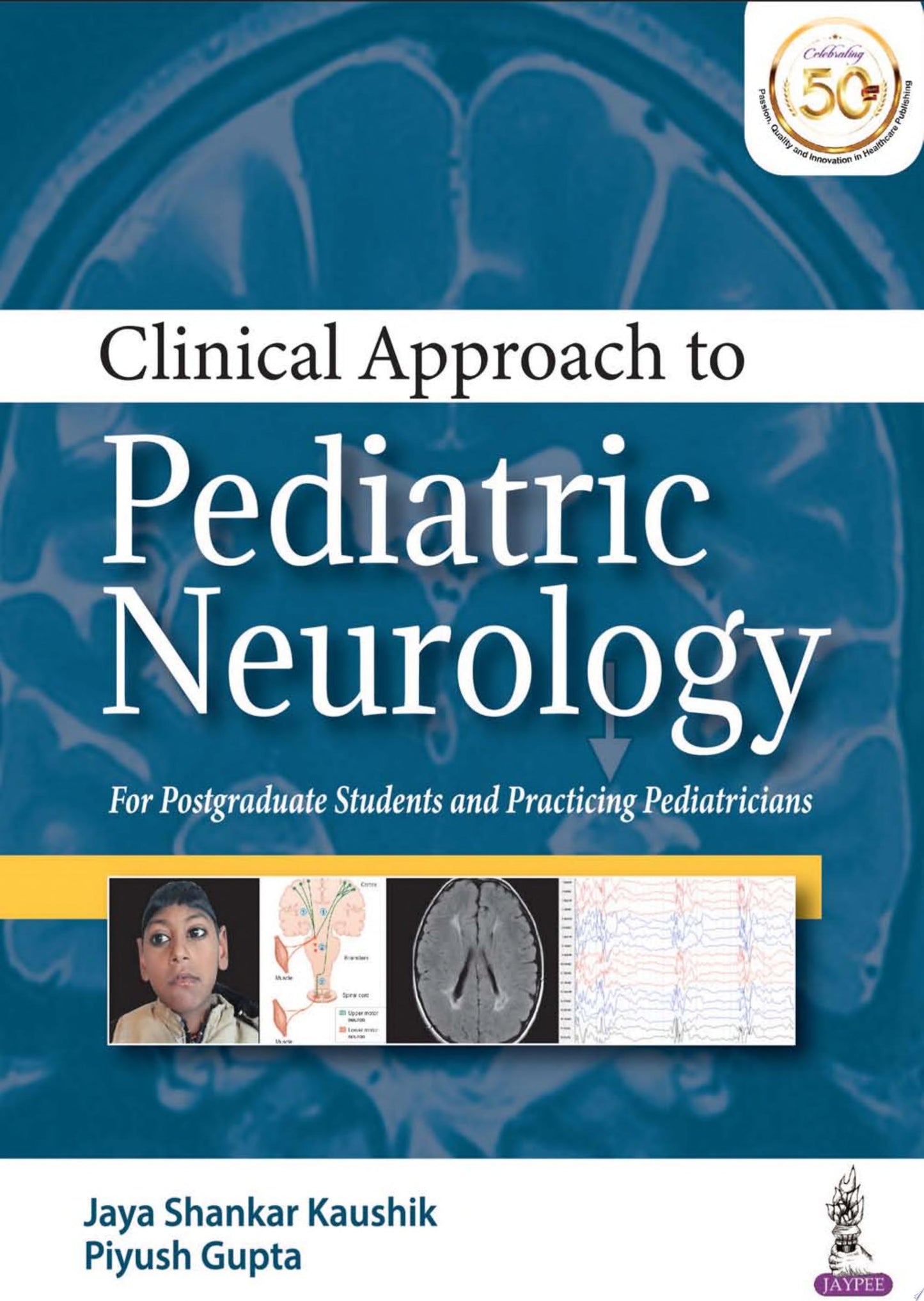 Clinical Approach to Pediatric Neurology