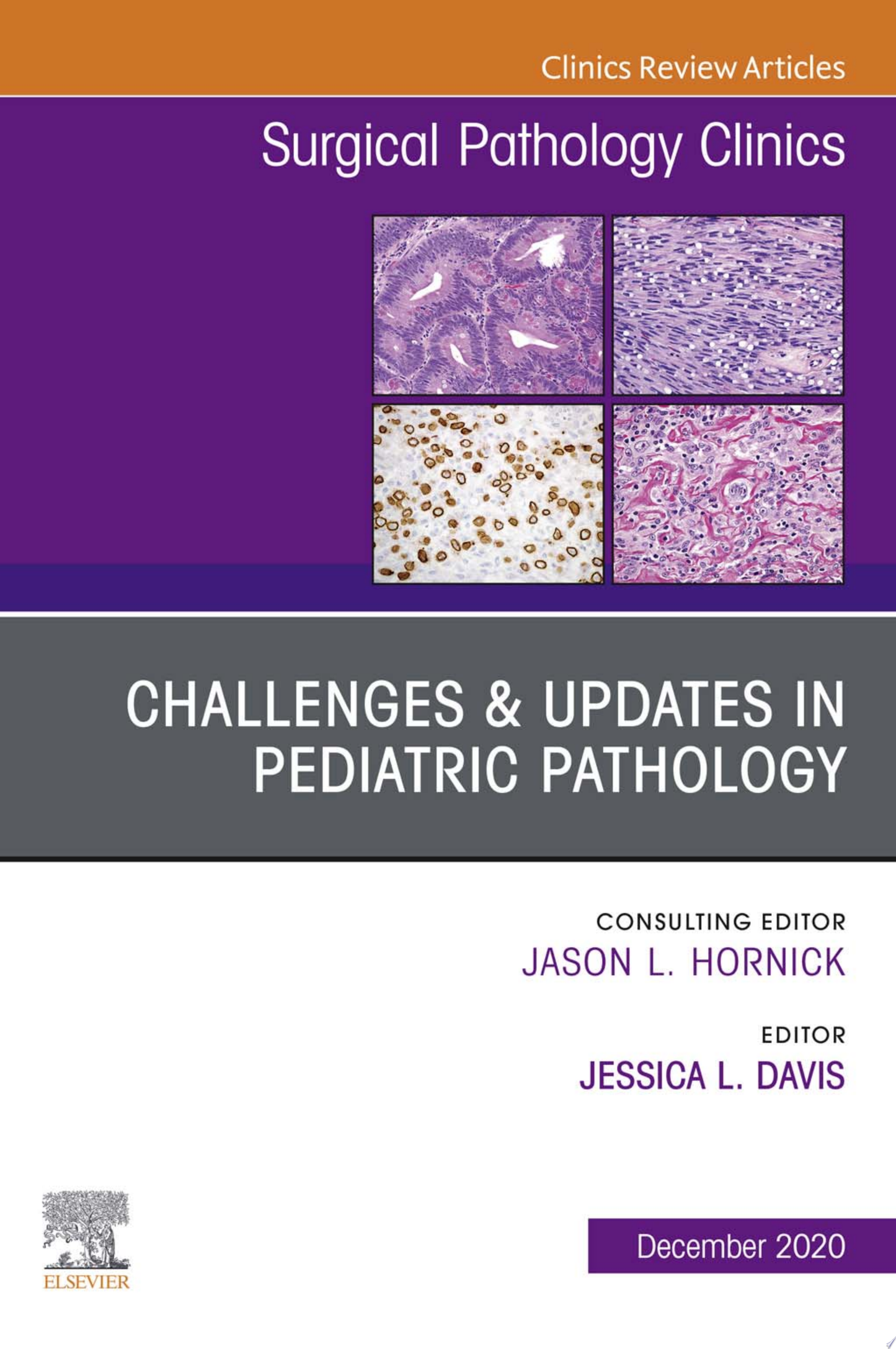 Challenges & Updates in Pediatric Pathology, An Issue of Surgical Pathology Clinics, E-Book