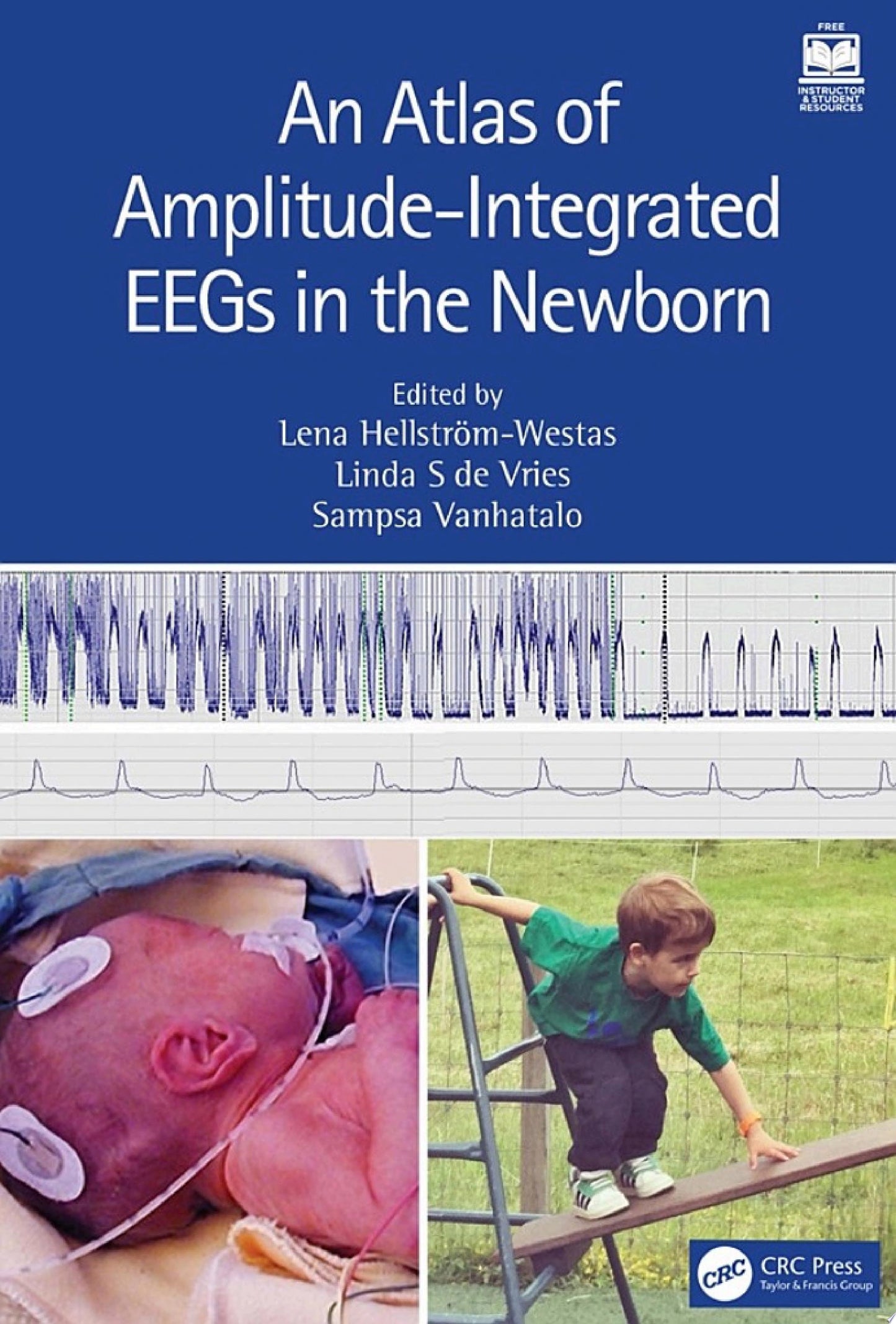 An Atlas of Amplitude-Integrated EEGs in the Newborn