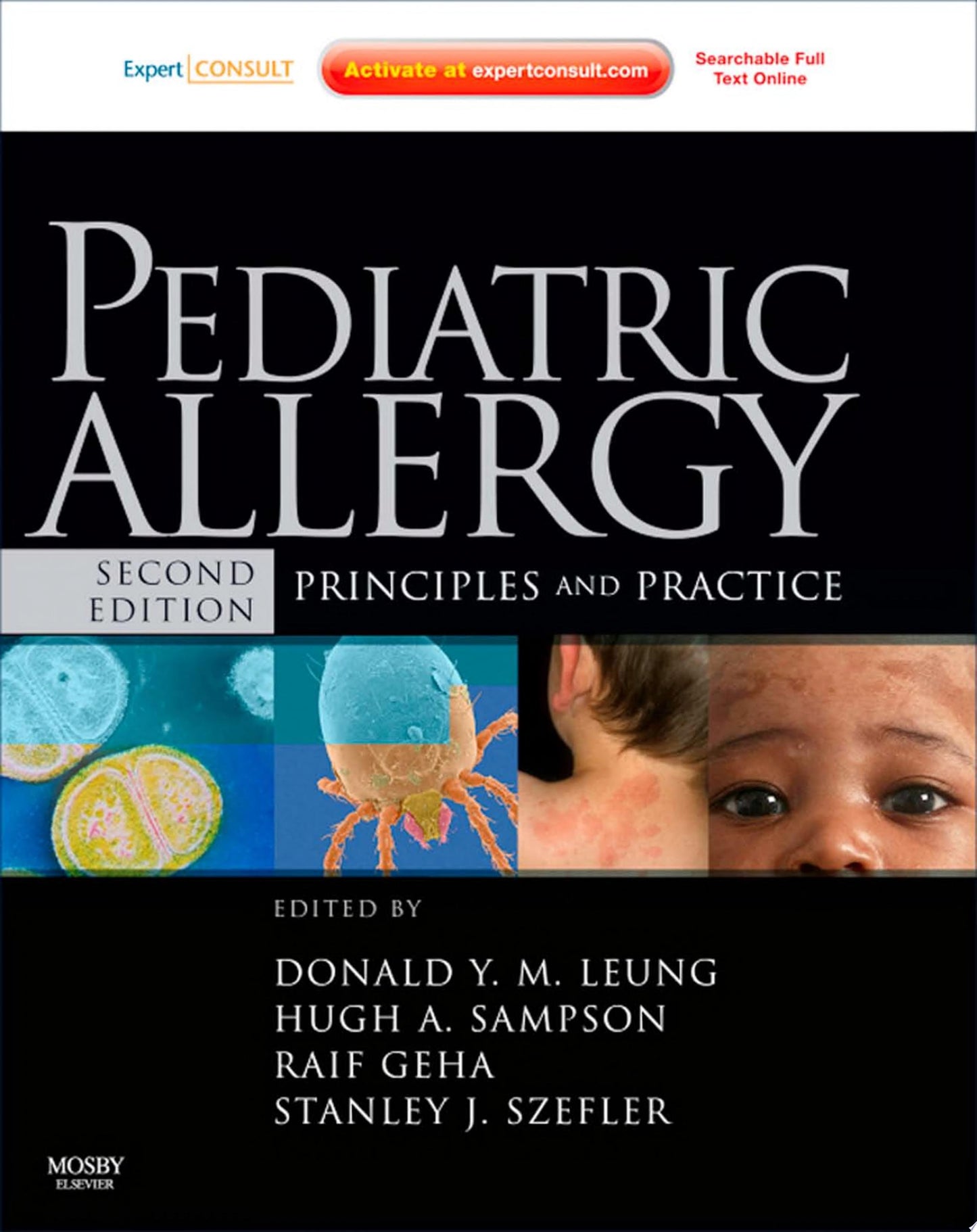 Pediatric Allergy: Principles and Practice E-Book