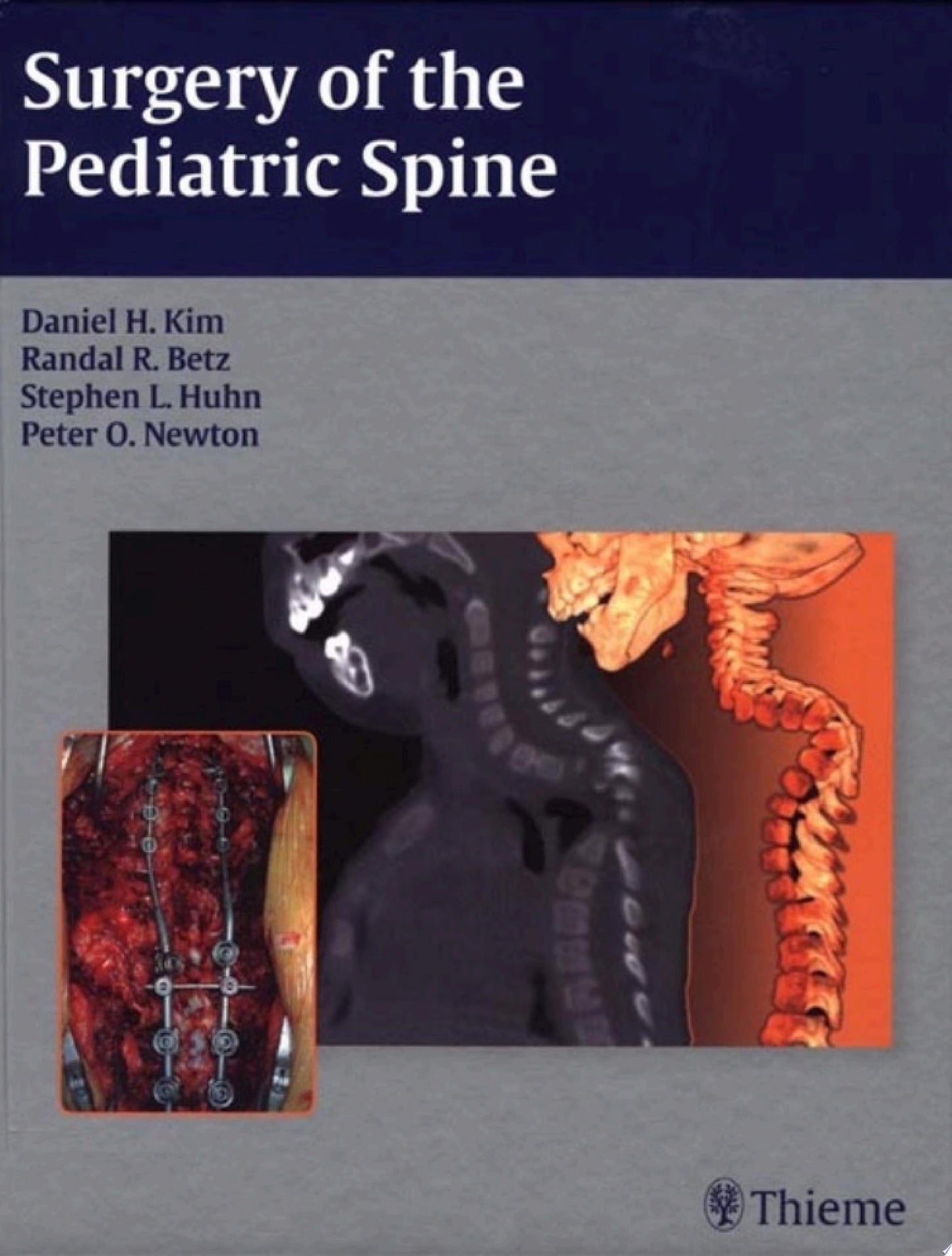 Surgery of the Pediatric Spine