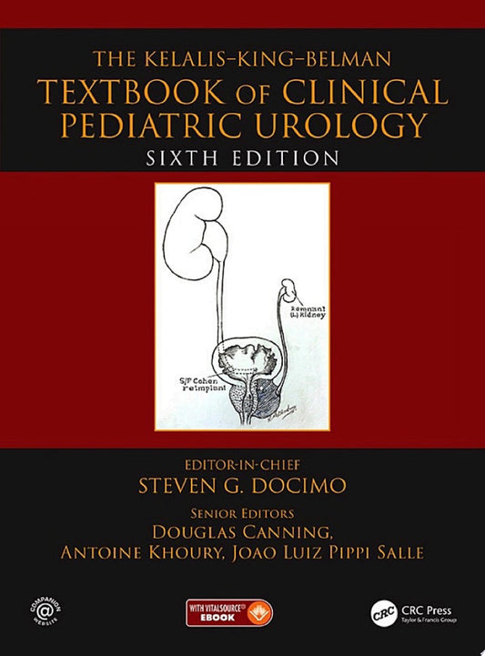 The Kelalis--King--Belman Textbook of Clinical Pediatric Urology