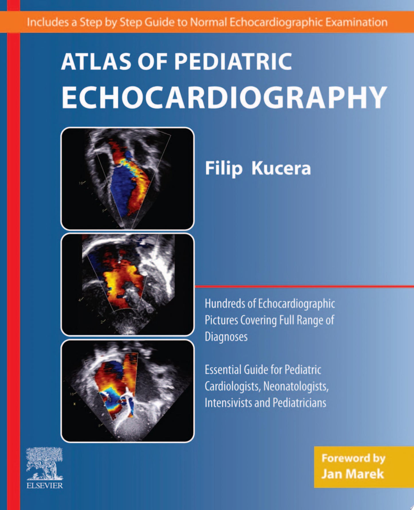 Atlas of Pediatric Echocardiography