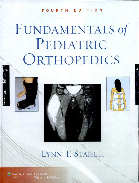 Fundamentals of Pediatric Orthopedics