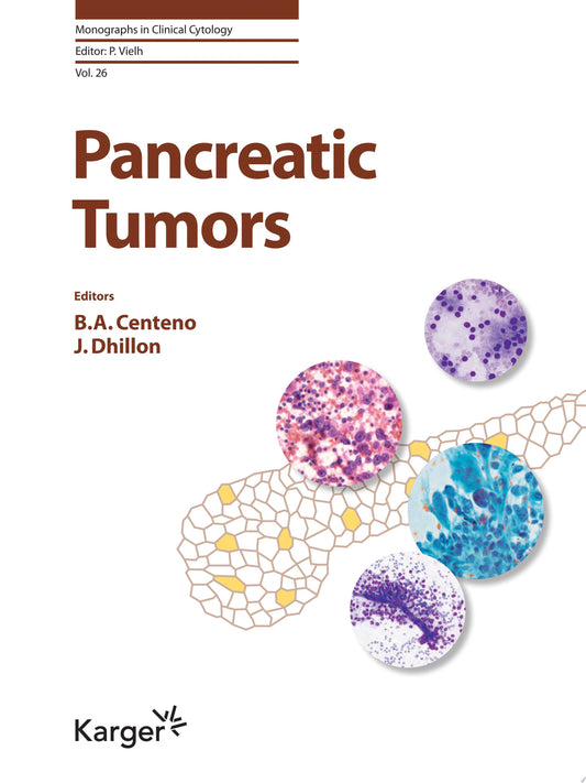 Pancreatic Tumors