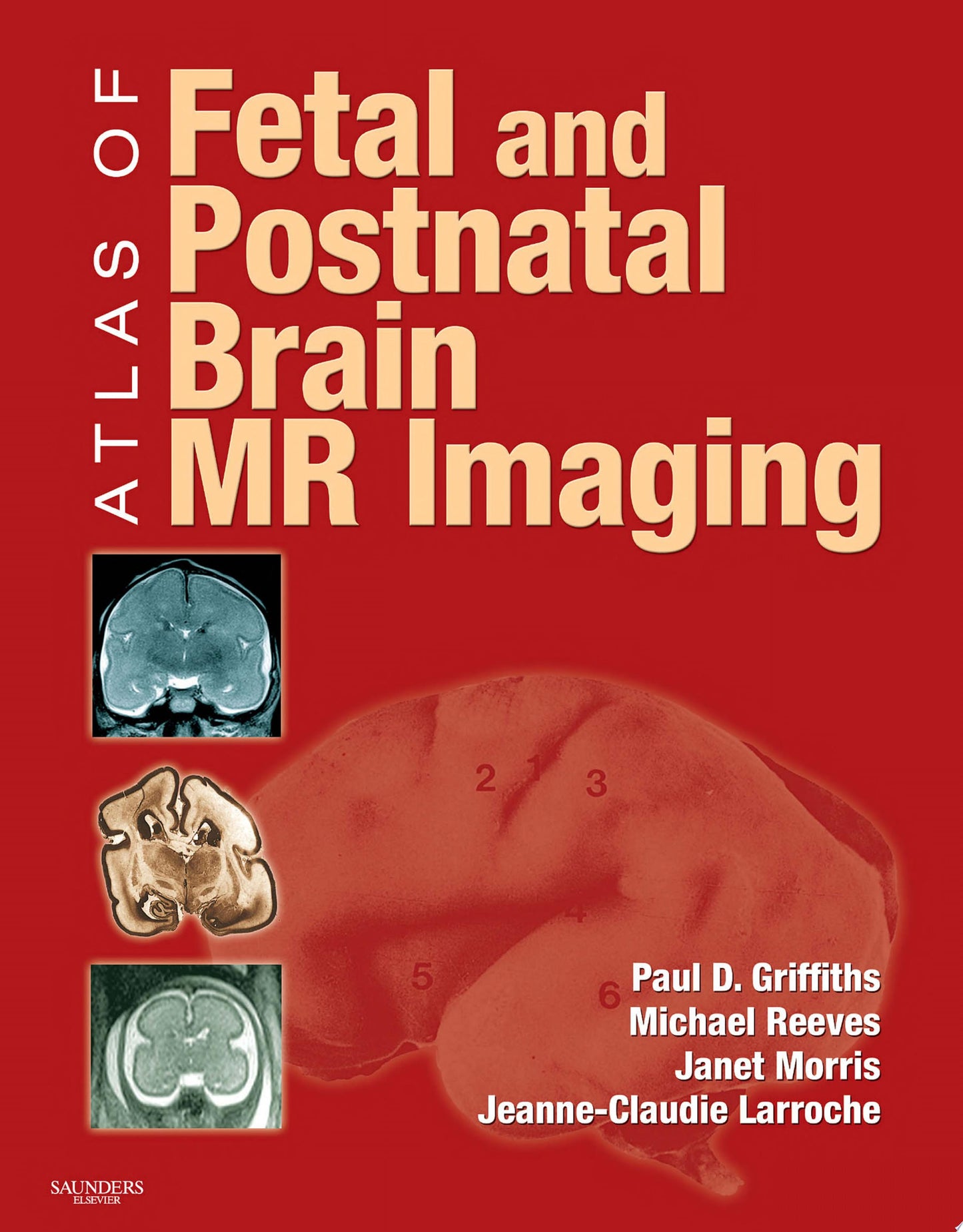 Atlas of Fetal and Postnatal Brain MR
