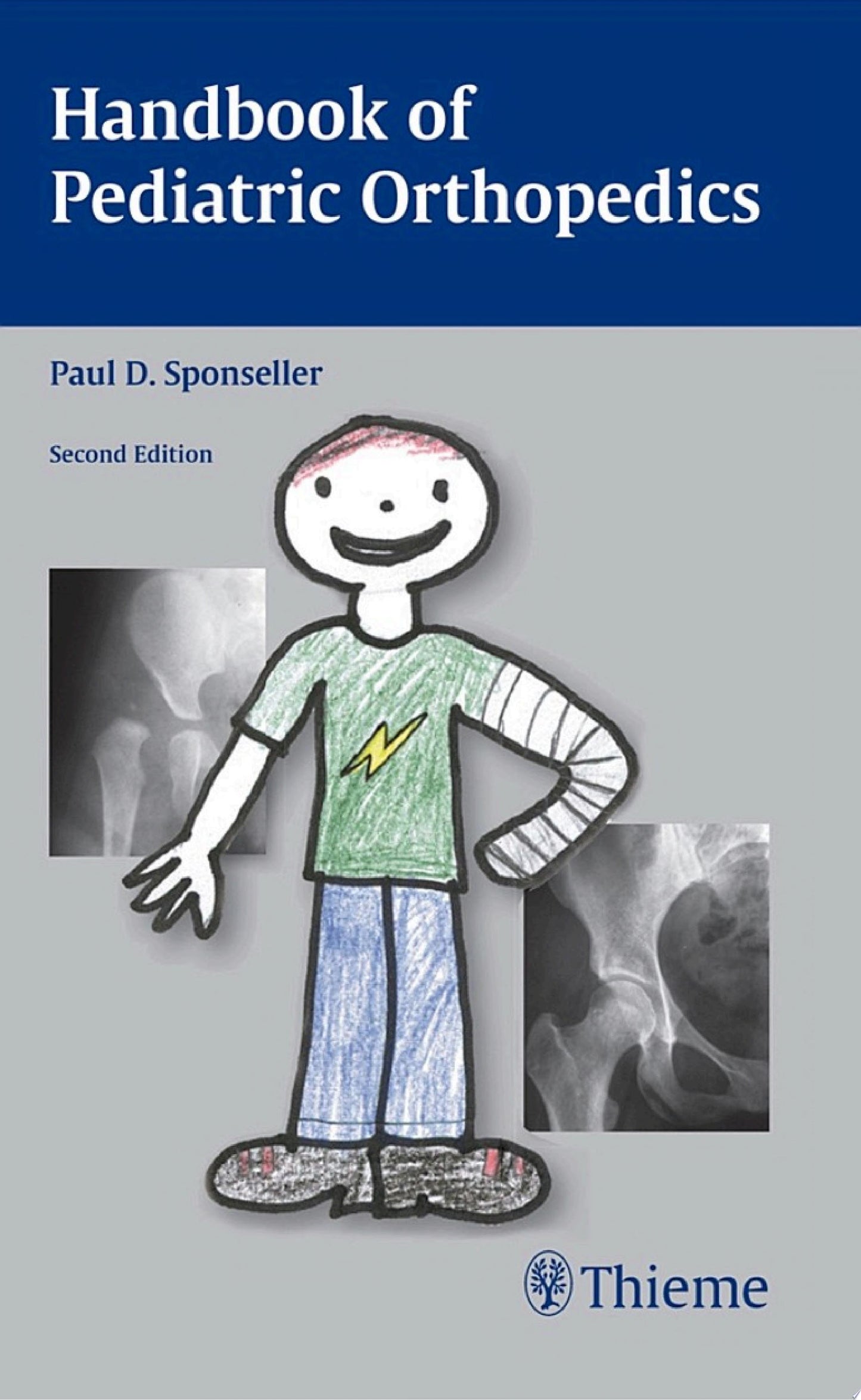 Handbook of Pediatric Orthopedics