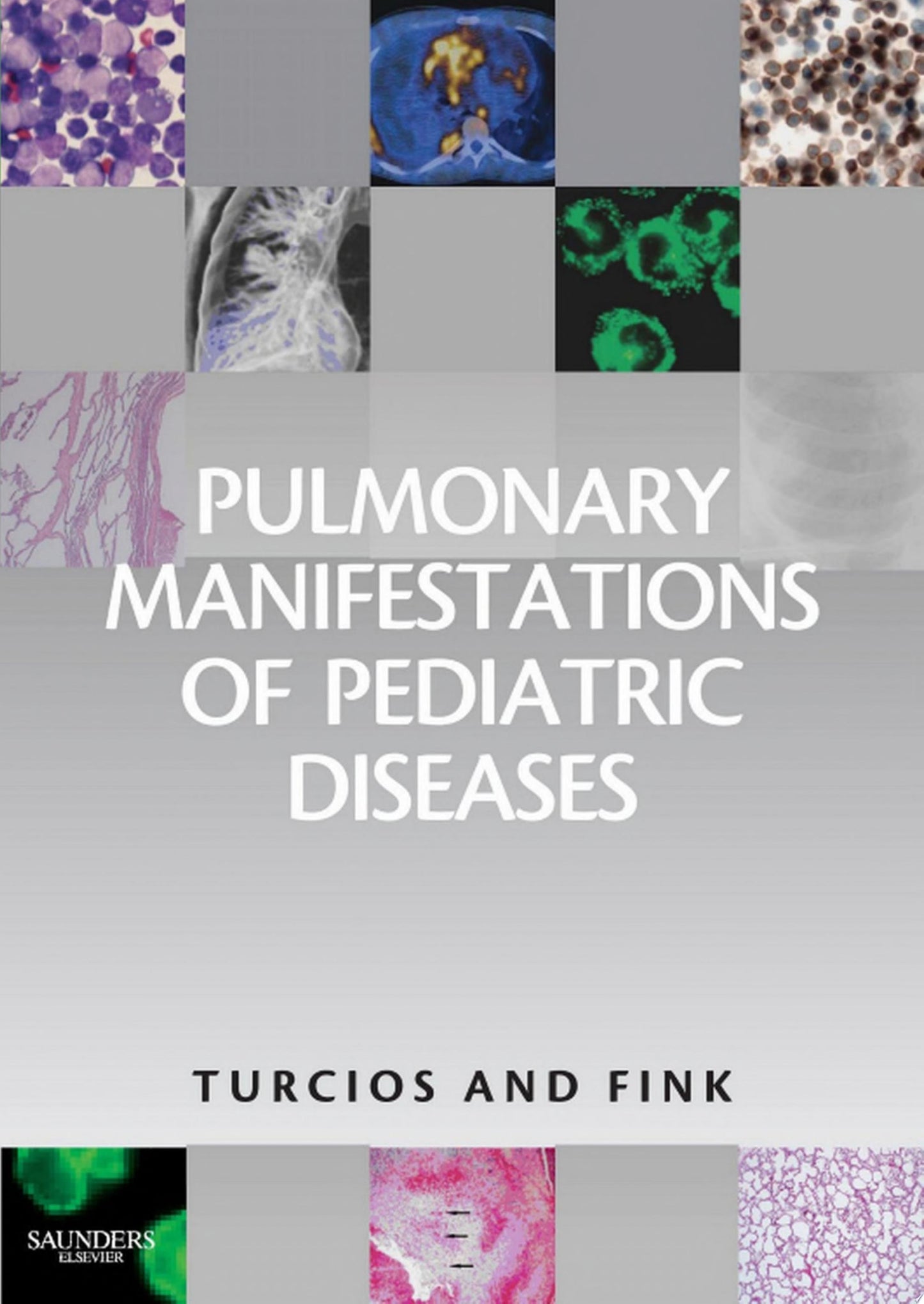 Pulmonary Manifestations of Pediatric Diseases E-Book