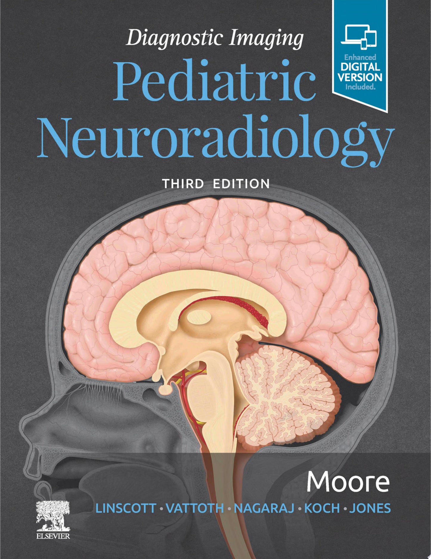 Diagnostic Imaging: Pediatric Neuroradiology E-Book